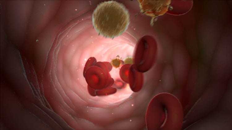 Illustration of blood cells and plaque inside an artery.